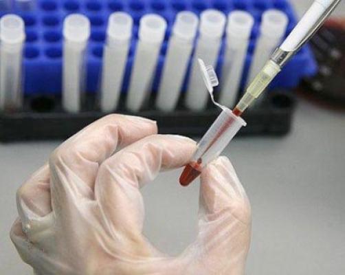 Năvodărenii s-au testat, gratuit, pentru depistarea HIV sau a hepatitei